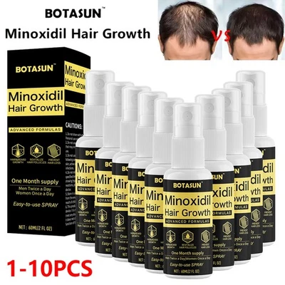 Minoxidil 5% Extra Strength Men 10 Month Supply Hair Regrowth Treatment Solution - Image 1 of 4