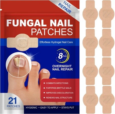 Anti-Fungal Nail Repair Patches – 21 Pack | Nail Fungus Treatment & Repair - Image 1 of 4