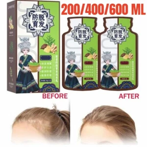 Ginger Plant Extract Anti-Hair Loss Hair Shampoo 10*20ml - Picture 1 of 11