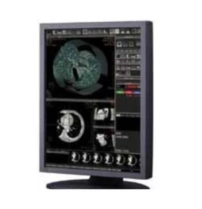 Monitor de video médico Totoku ME251M 21,3" 2 MP LCD - NUEVO EN CAJA - Imagen 1 de 1