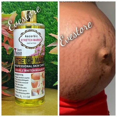 Ascorbic stretch-mark Oil,Body Oil For Scars & Stretch marks,oil Hydrates,Fades - Image 1 of 3