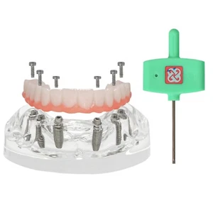Dental Implant Restoration Model Upper Jaw 6 Screws Post Core Bridges M6001-2 - Picture 1 of 9