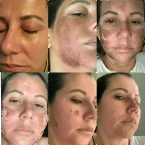 MONNASKIN Algae Pell (peeling De Algas ) - Picture 1 of 15