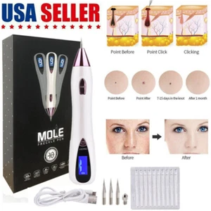 Anti-Aging Laser Plasma Pen Skin Tag Mole Removal Dark Spot Remover Wart Tattoo - Picture 1 of 15