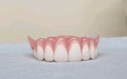Zahnprothese,dentures,zahnersatz,prothese,oberkiefer,false teeth,Hufeisen.