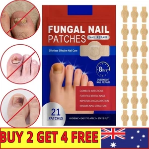 21 parches antifúngicos para el tratamiento de uñas dedo del pie hongos onicomicosis pegatina para reparación ~ - Imagen 1 de 13