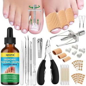 Ingrown Toenail Tools Kit, Treatment, Stainless Steel... - Picture 1 of 9