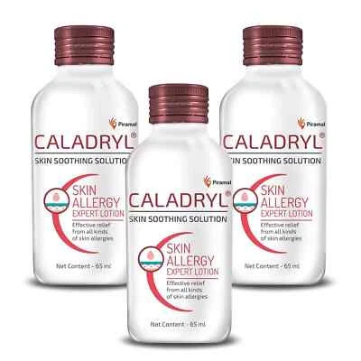 Caladryl Skin Allergy Expert Lotion-Pack of 3 (3 x 65 ml) For skin Problems - Image 1 of 4
