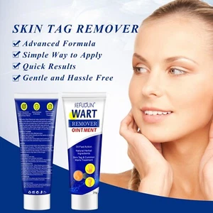 20G Wart Removal Cream Filiform Warts Body Flat Wart Cream Removr Ointment - Picture 1 of 16