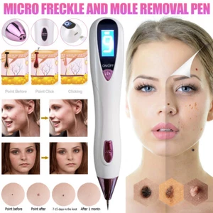 Electrico Laser Verrugas Quita Remover Pen Para Mezquinos Maquina Elimina Pecas - Picture 1 of 15