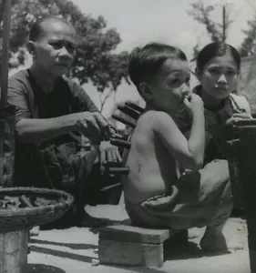 Viêt-Nam. Médecine. Application de ventouses. Circa 1950. Indochine. - Foto 1 di 2