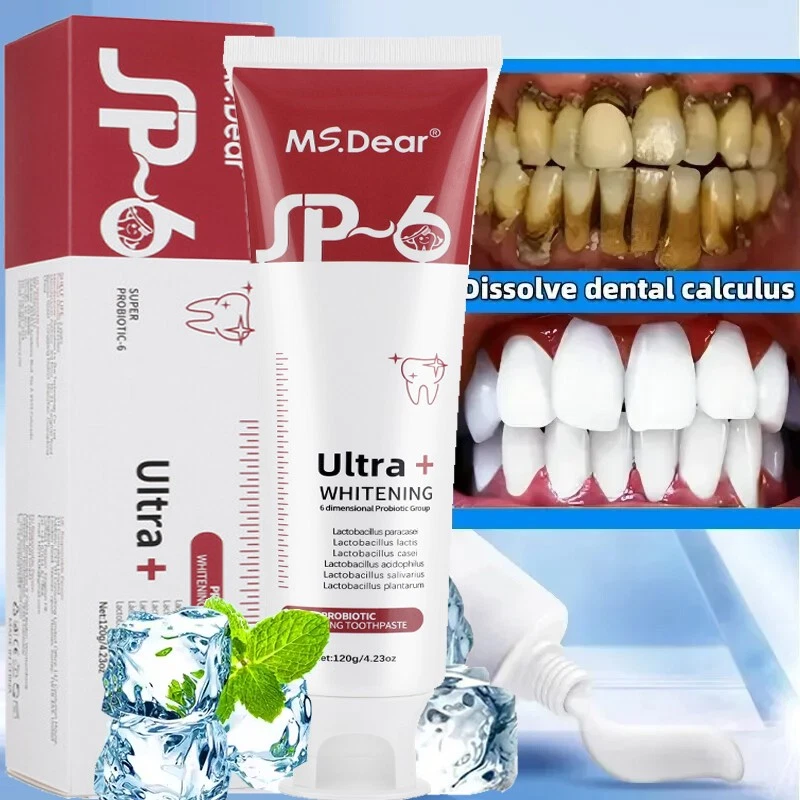 MS.DEAR SP-6 Probiotic Toothpaste, SP-6 Toothpaste Ultra Whitening Quick Fresh Breath