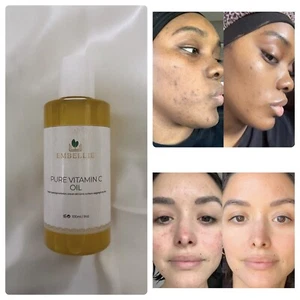Vitamin C Oil, brightening body oil, Anti aging, blemish Free, Dark Spot Remover - Picture 1 of 1