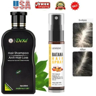 Anti Hair Loss Shampoo Natural Herbal Fast Hair Growth Treatment Hair Regrowth - Image 1 of 4