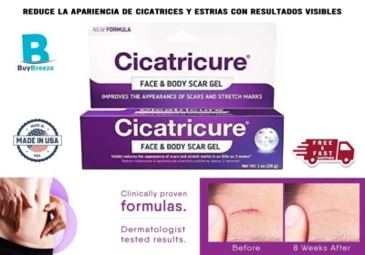 Cicatricure crema para borrar eliminar cicatrices quemaduras manchas cortadas EE. UU. Foto 1 de 4