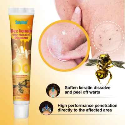 SUMIFUN New Bee Venom Warts Remover 20g Ointment Skin Tag Treatment Remove Wart Cream