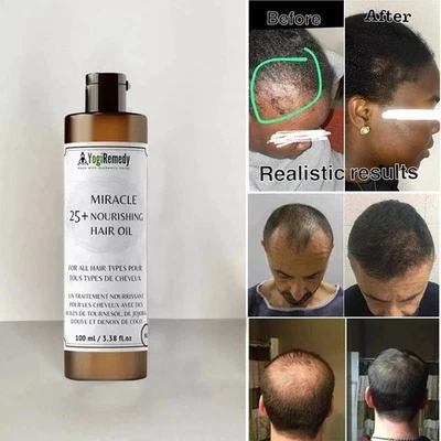 Organic Hair Growth Oil treatment 3.4 oz. Alopecia,Bald Spots,Thinning hair - Image 1 of 4