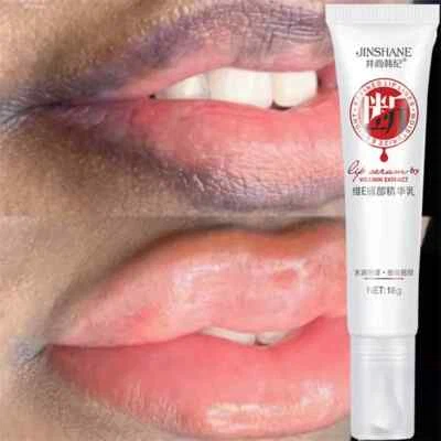 Crema aclaradora de labios oscuros Elimina los labios ahumados oscuros frescos Foto 1 de 4