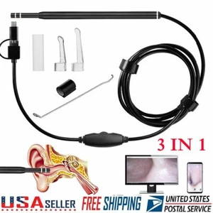3in1 Ear Cleaning Endoscoper USB Visual Earpick HD Camera Spoon Otoscope Cleaner - Picture 1 of 12