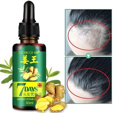 ReGrow 7 Days Ginger Germinal Serum Essence Oil Hair Loss Treatement Fast Growth