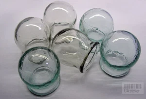 LOT 6 ANTIQUE Medical Phlebotomy BLOOD LETTING FIRE CUPPING GLASS CUPS Set USSR - Picture 1 of 4