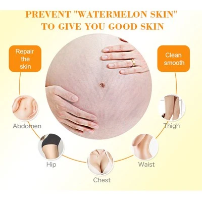 Stretch Marks Repair Cream Enhance Elastic Moisturizing Skin Tightening Marks - Image 1 of 4