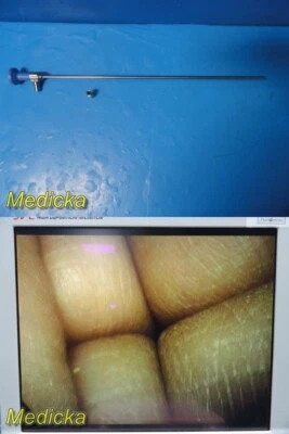 Laparoscopio bariátrico rígido Stryker Ideal Eyes 502-205-045 5 mm x 45 °; HD ~ 36878 Foto 1 de 4