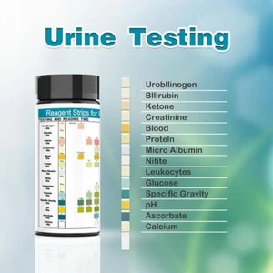 URS-14 100 strips Urinalysis Reagent Test Paper 14 Parameters Test Strips R5I8 - Picture 1 of 11