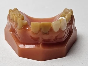 Vintage Denmat Teeth Model Mold - Picture 1 of 7