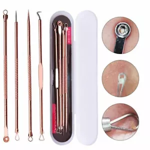 BLACKHEAD WHITEHEAD COMEDONE SPOT PIMPLE BLEMISH EXTRACTOR REMOVER TOOL SET KIT - Picture 1 of 12