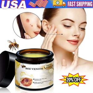 Bee Venom Skin Tag Removal Treatment Cream Body Care Mole Corn Wart Remover - Picture 1 of 12