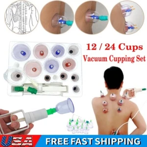 12 Cups / 24 Cups Medical Chinese Vacuum Full Body Cupping Massage Suction Set - Picture 1 of 14