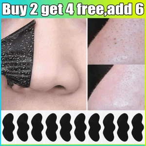 10Pcs Nose Pore Strips Blackhead Removal Unclog Pores Smooth Deep Cleansing Hot - Picture 1 of 13