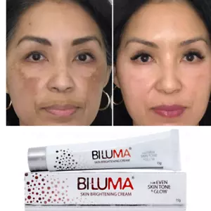 Biluma Advance Sensitive Areas Brightening Cream For Even Skin Tone & Glow -15g - Picture 1 of 4