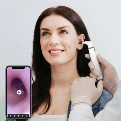 TESLONG 5-in-1 3.9mm Wifi Otoscope for iPhone / iPad / Android / Tablet - Bild 1 von 4