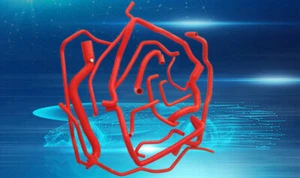 RED Silicone Coolant Hose FOR Renault 5 R5 GT Turbo 1988-1991 89 90 91 1989 - Imagen 1 de 5