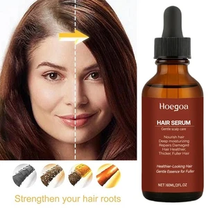 Spray Crescita Capelli 60ml Anti Perdita Capelli Ricrescita Rapida Cuoio Capelluto Trattamento Siero ✲ - Foto 1 di 11