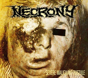 Necrony - severe malignant pustule (Slipcase Digi CD), Remastered, OVP, NEW - Bild 1 von 3