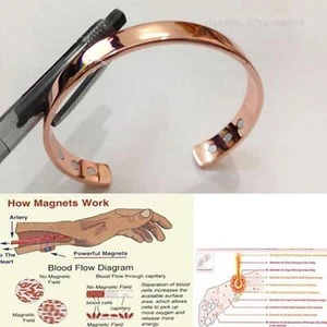 Bracelet Magnetic Arthritis Therapy Energy Healing Pain Relief GiftUK- - Picture 1 of 10