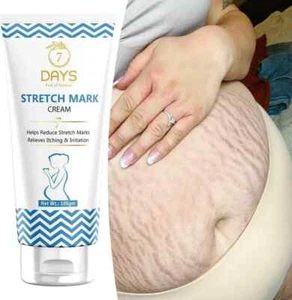 7 DAYS stretch Cream for Stretch Marks Removal Post Pregnancy fast work (100 g) - Picture 1 of 2