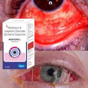 Eye Drops 5ml for Conjunctivitis & Eye Wash & Complete Eye Care free shipping - Picture 1 of 2