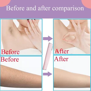 Herramienta eléctrica Sonic Smooth maquinilla de afeitar recargable con 6 Dermablades de recarga - Imagen 1 de 7