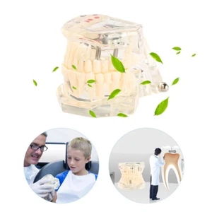 Denture Education Dental Disease Fake Teeth Model Tooth Teaching Model Tools - Picture 1 of 6