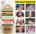 Best Ayurvedic Remedy Inflammed Scalp Fungus Herbal Tea Tree Conditioner 500 Ml