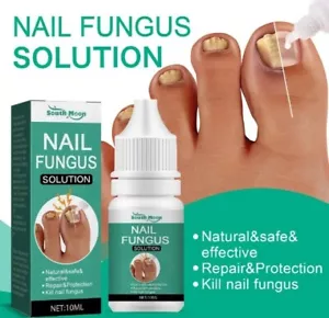GEGEN NAGELPILZ Behandlung Fußpilz Gel Hände Fußpflege Reparatur Füße 10 ml 🇩🇪 - Bild 1 von 11
