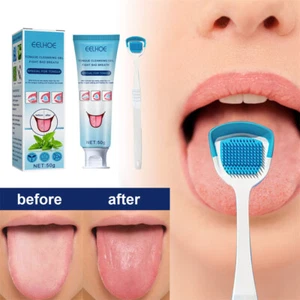 Kit de respiración fresca para raspador y limpiador de lengua de mal aliento con gel de limpieza - Imagen 1 de 12