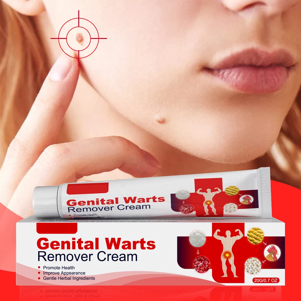 Genital Herpes Wart Remover Ointment Skin Tag Mole Acuminatum Treatment Cream~