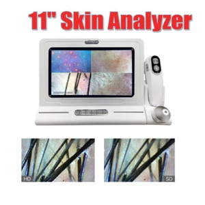 2025 Portable Handheld Skin Scalp Detector Hair Diagnosis analyzer Smart Device - Picture 1 of 10