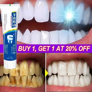 For Gingivitis Treatment Cavity Loose Teeth Care Toothpaste Loose Tooth Repair - Picture 1 of 20