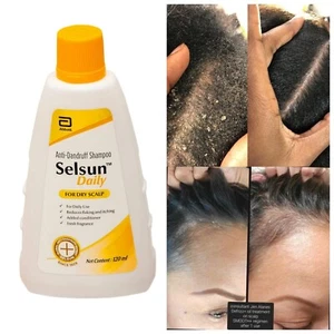 Selsun Daily Anti-Schuppen Shampoo für trockene Kopfhaut 120 ml - Bild 1 von 9